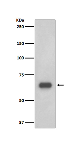 p70 S6 Kinase Rabbit mAb