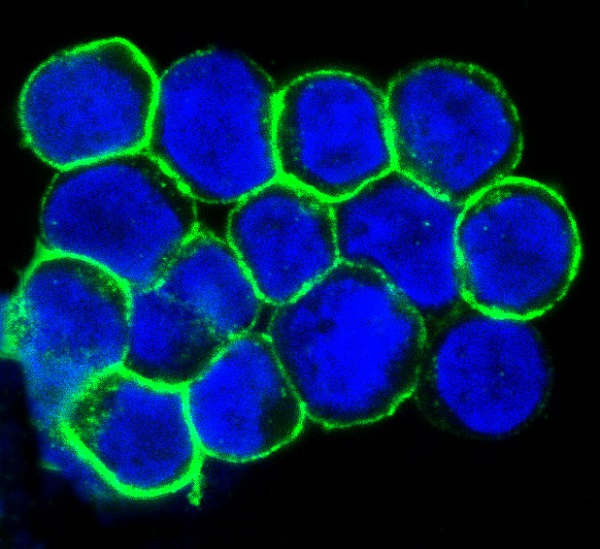 CXCR4 Rabbit mAb