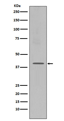 CXCR4 Rabbit mAb