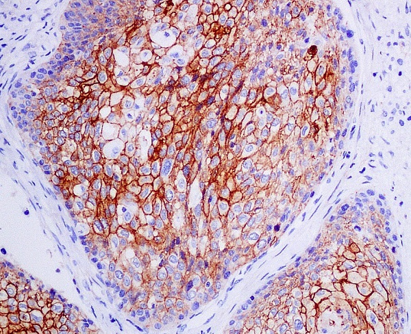 CXCR4 Rabbit mAb