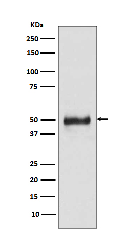 Cytokeratin 8 Rabbit mAb