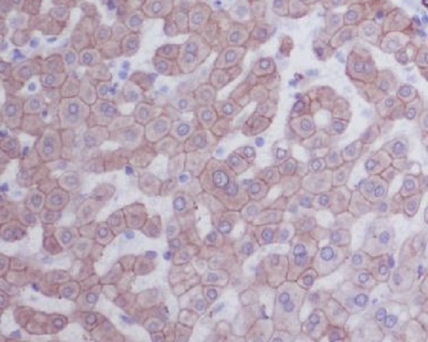 Cytokeratin 8 Rabbit mAb