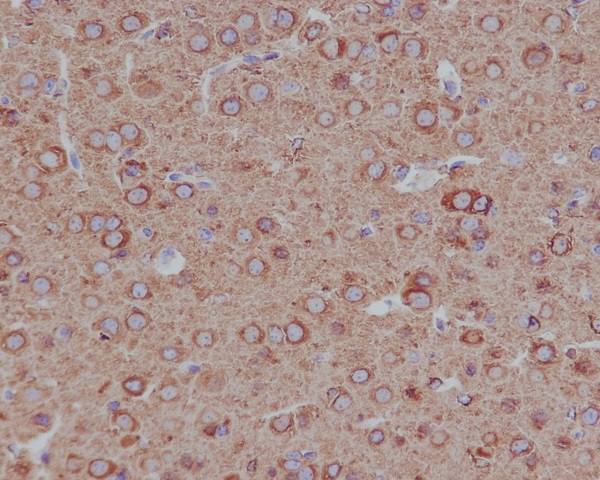 beta II Tubulin Rabbit mAb 