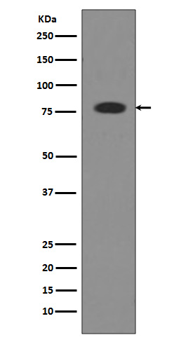 Transferrin Rabbit mAb 