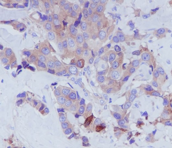 Transferrin Rabbit mAb 