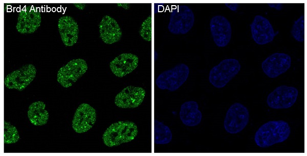 Brd4 Rabbit mAb