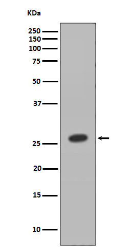 HOXB9 Rabbit mAb