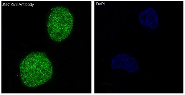 JNK1/2/3 Rabbit mAb