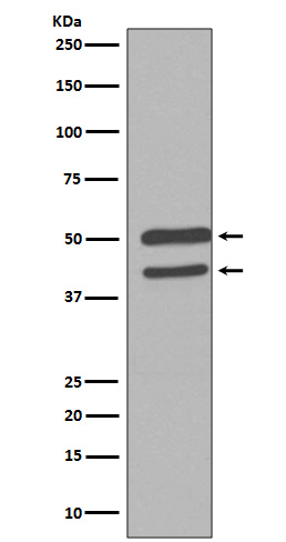 JNK1/2/3 Rabbit mAb