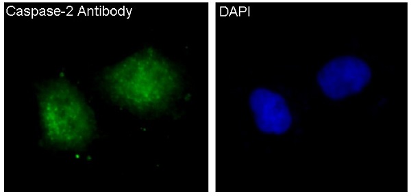 Caspase-2 Rabbit mAb