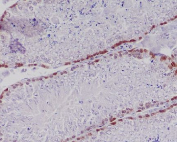 Caspase-2 Rabbit mAb