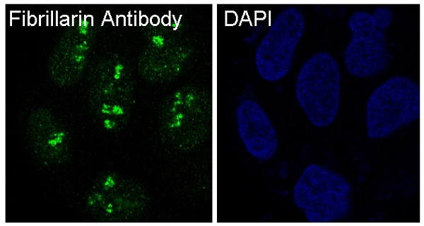 Fibrillarin Rabbit mAb