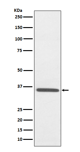 Fibrillarin Rabbit mAb