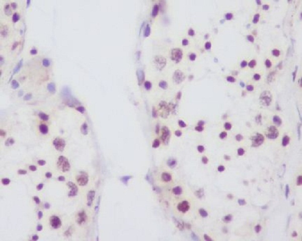 Fibrillarin Rabbit mAb