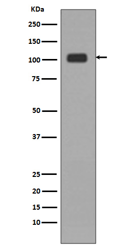 KDM1/LSD1 Rabbit mAb