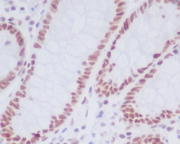 KDM1/LSD1 Rabbit mAb