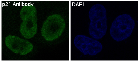 p21 Rabbit mAb 