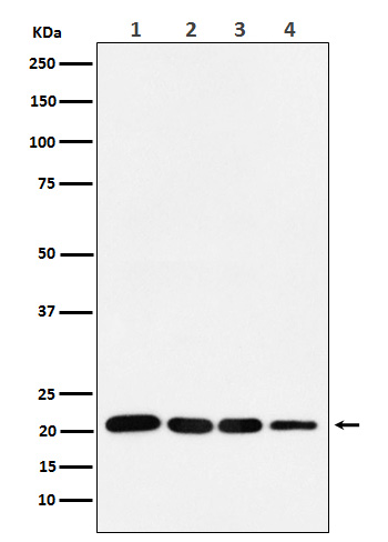 p21 Rabbit mAb 