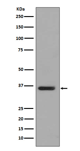 PP2A alpha + beta Rabbit mAb