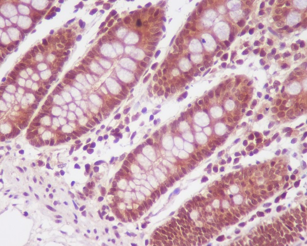 PP2A alpha + beta Rabbit mAb