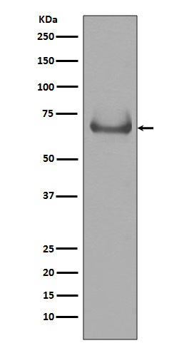 Lamin B Receptor Rabbit mAb