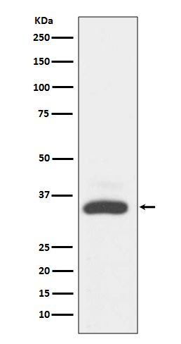 MAD2L1BP Rabbit mAb