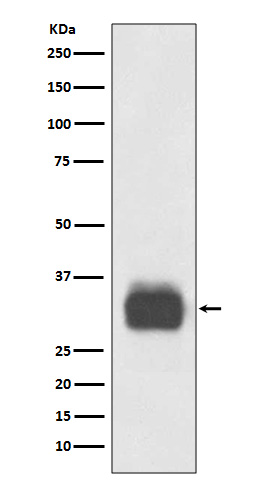 Mast Cell Tryptase Rabbit mAb