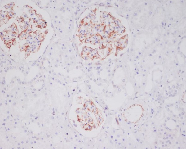 Mast Cell Tryptase Rabbit mAb