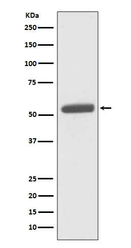 PKM2 Rabbit mAb