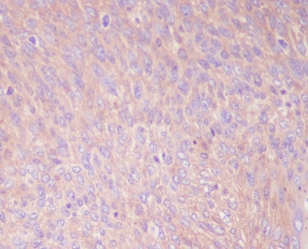 PKM2 Rabbit mAb