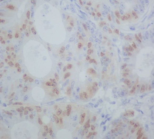 Cyclin A1/A2 Rabbit mAb