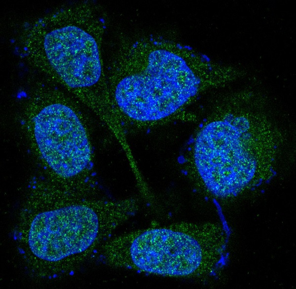 MEK3/MEK6 Rabbit mAb