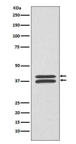 MEK3/MEK6 Rabbit mAb