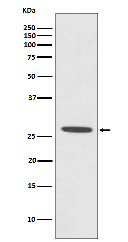 CDCA3 Rabbit mAb