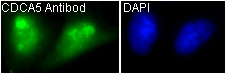 CDCA5 Rabbit mAb