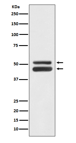 JNK1/JNK3 Rabbit mAb