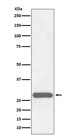 CITED2 Rabbit mAb