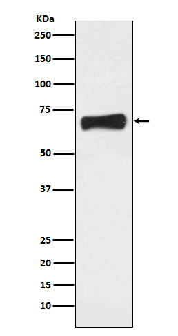 NR5A2 Rabbit mAb