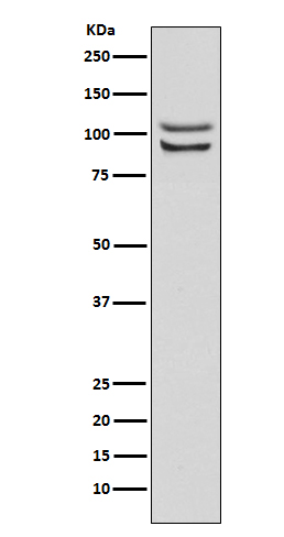 FGFR4 Rabbit mAb