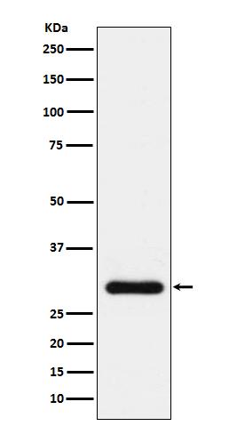 BNP Rabbit mAb