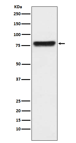 KLKB1 Rabbit mAb