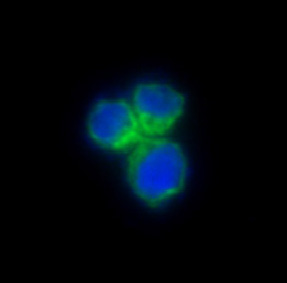 CCR8 Rabbit mAb