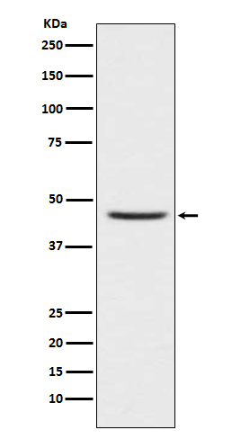 CCR8 Rabbit mAb