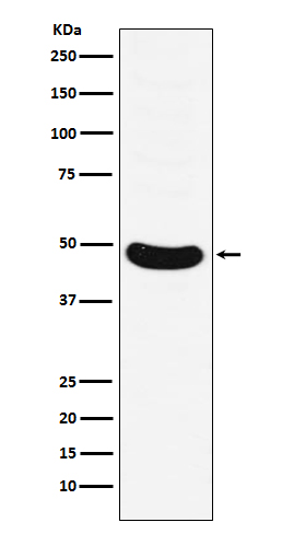 HB9/HLXB9 Rabbit mAb