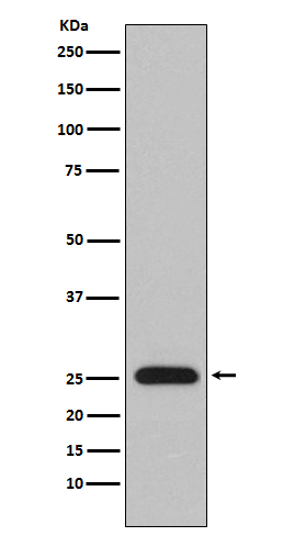 Lambda Light chain Rabbit mAb