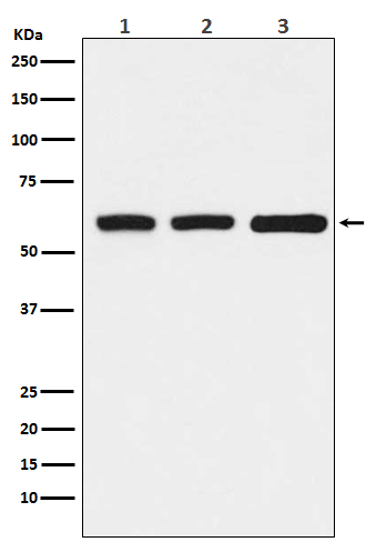 KAT9 / Elp3 Rabbit mAb