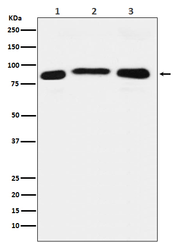 LSD2 / AOF1 Rabbit mAb