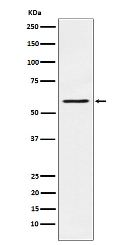 PAK1 Rabbit mAb