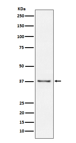 CD23 Rabbit mAb