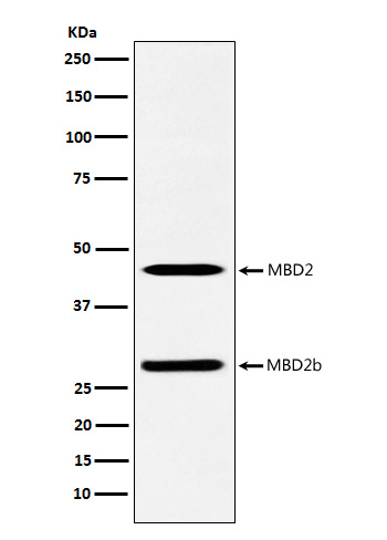 MBD2 Rabbit mAb